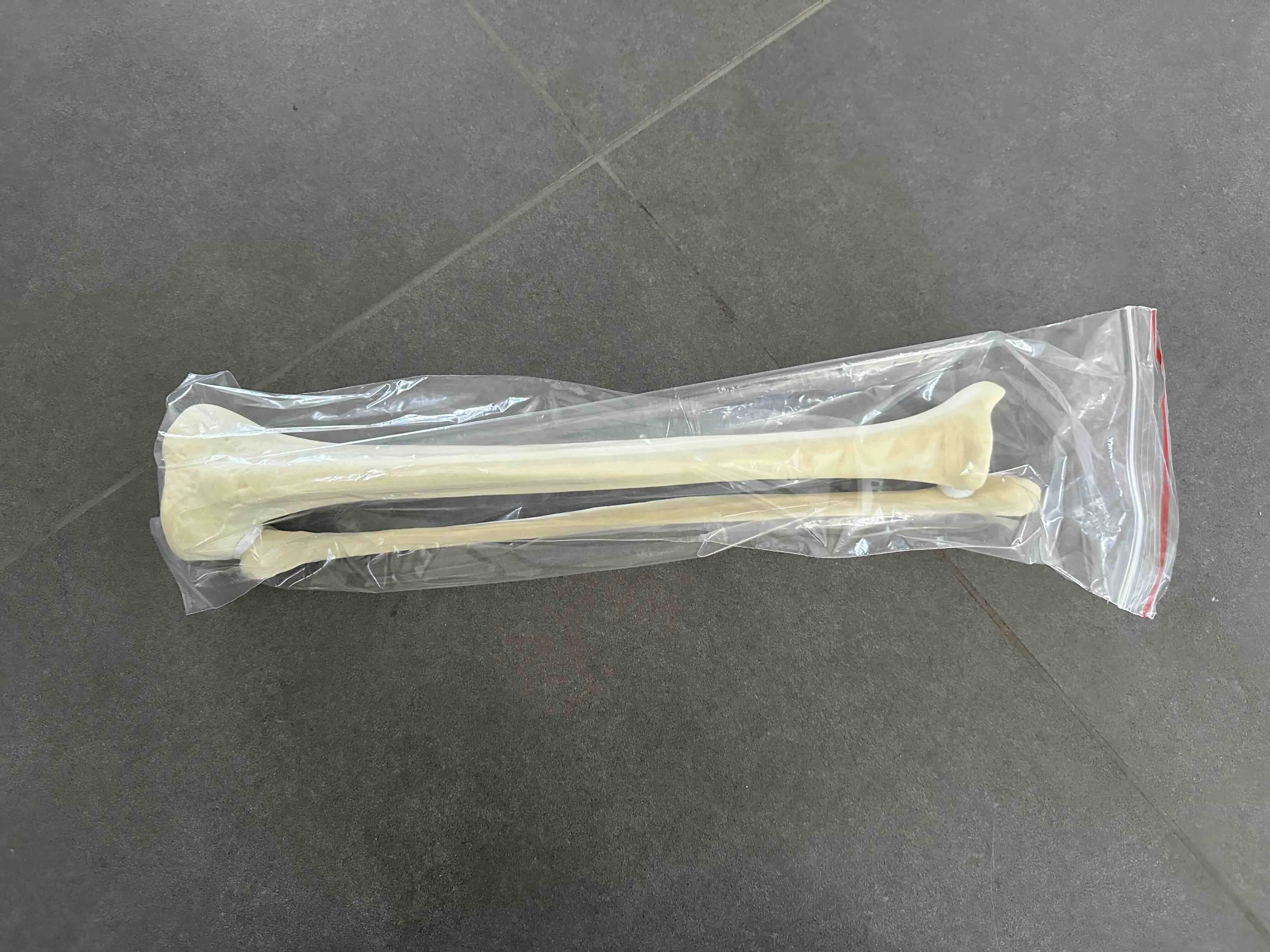 KyrenMed Solid Foam Cortical Human Tibia and Fibula Model Simulated ...