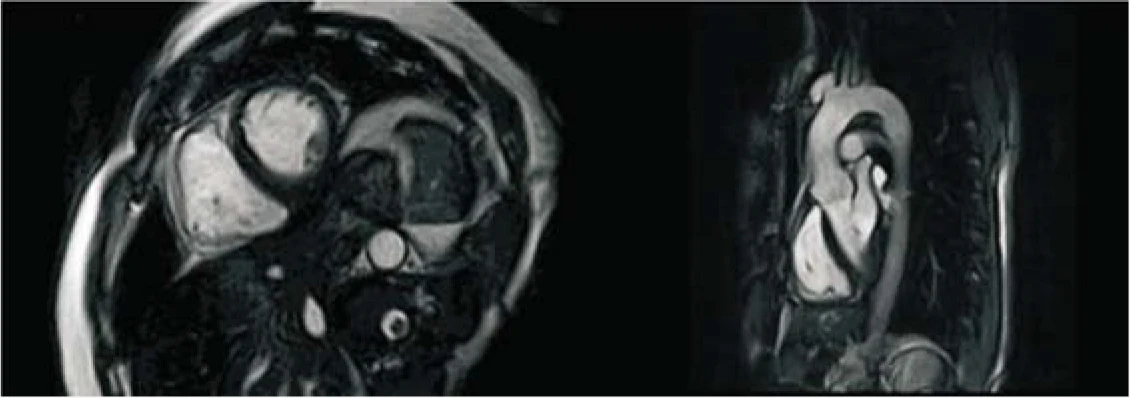 Hospital Medical Magnetic Resonance Imaging System 1.5T  MRI Machine with A-combi and Al Technologies manufacture