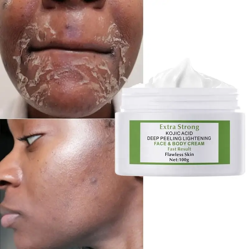 60/100g Customized Extra Strong Kojic Acid 7days Lightening