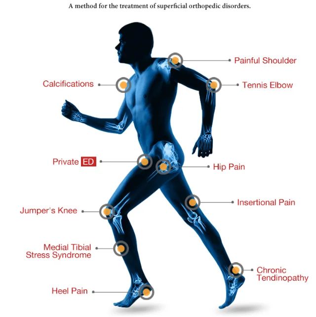 manufacture 2021 new shockwave therapy machine for your health