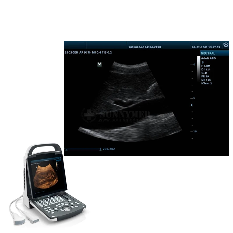 High Quality Medical Ultrasound Machine Mindray DP-20 Potable Digital Ultrasound Device for Abdomen, OB, GYN, Cardiology