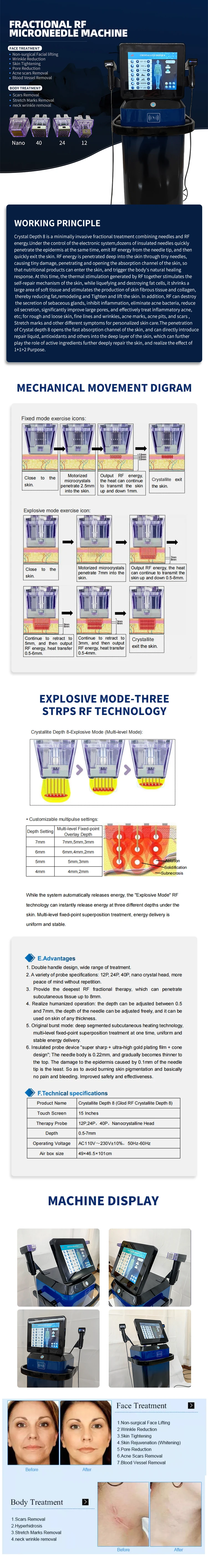 Stretch Marks Removal Machine Radio Frequency Fractionalmicroneedle Machine Wrinkles Reduction Scars Removal