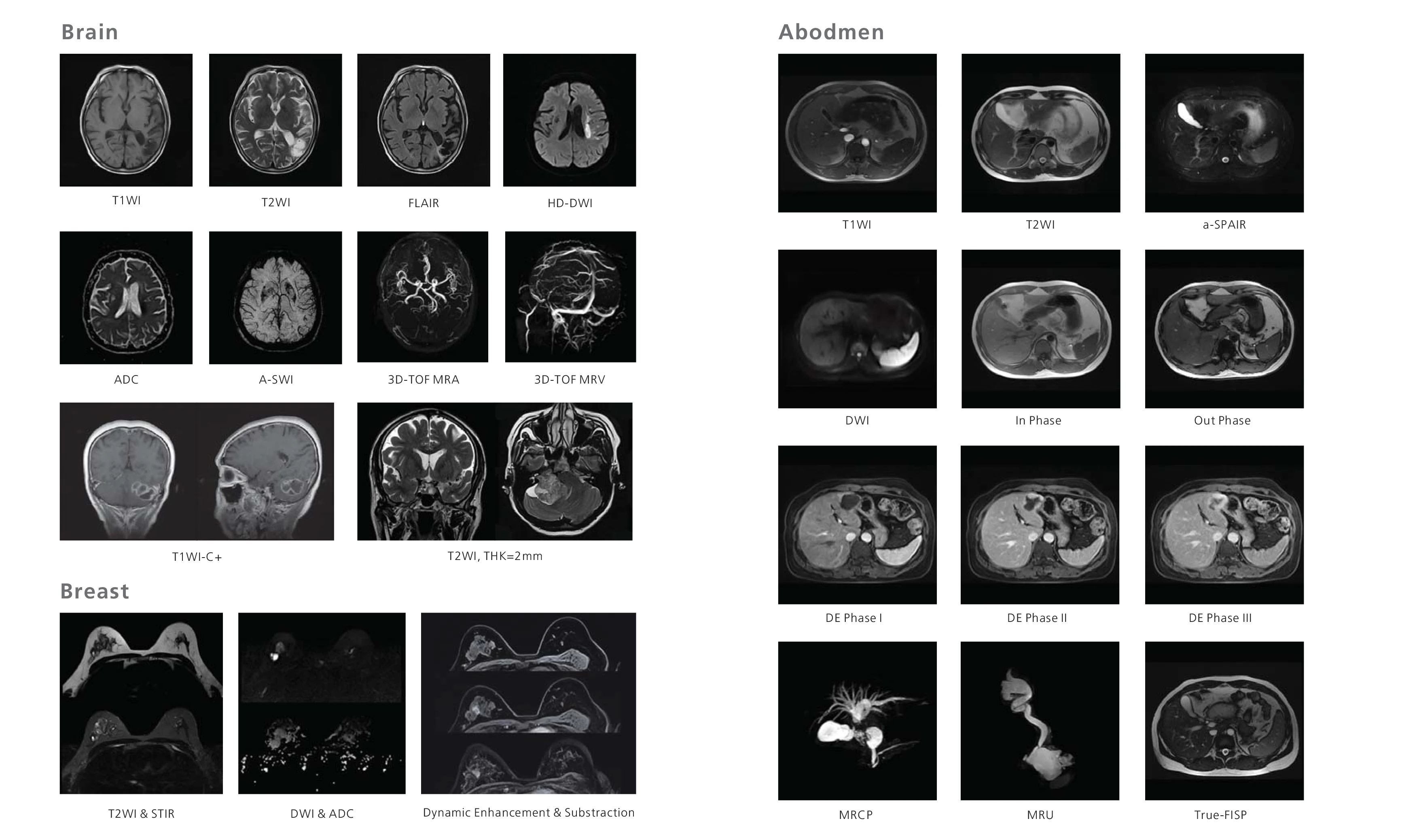 Hospital Medical Magnetic Resonance Imaging System 1.5T  MRI Machine with A-combi and Al Technologies factory