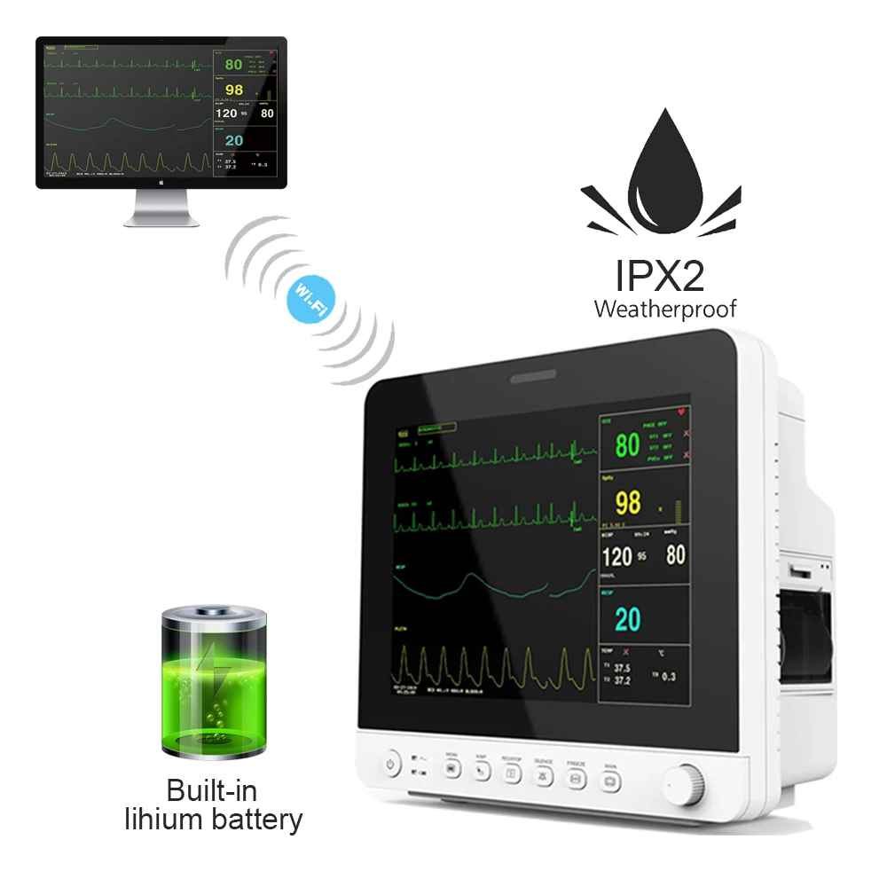 CONTEC монитор пациента vitals monitor со встроенной литиевой батареей настенное