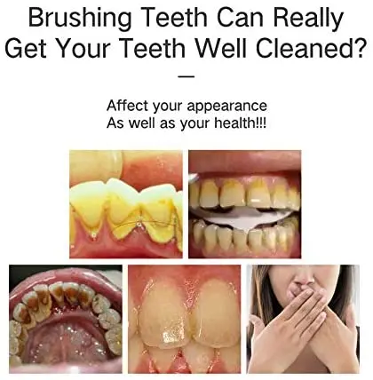 teeth cleaner (17)
