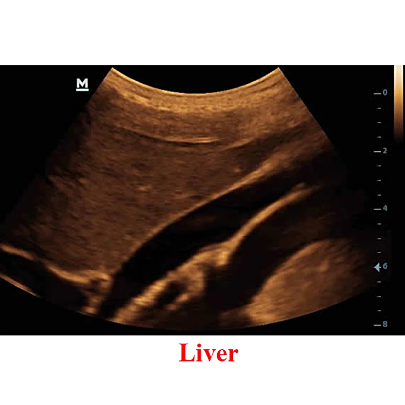 Liver.jpg