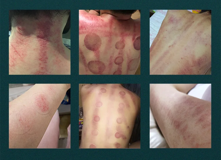 Cavitation Machine 9 in 1 Body Slimming Therapy Machine Desktop 80K Multi-Function Negative Pressure Cavitation Beauty Machine