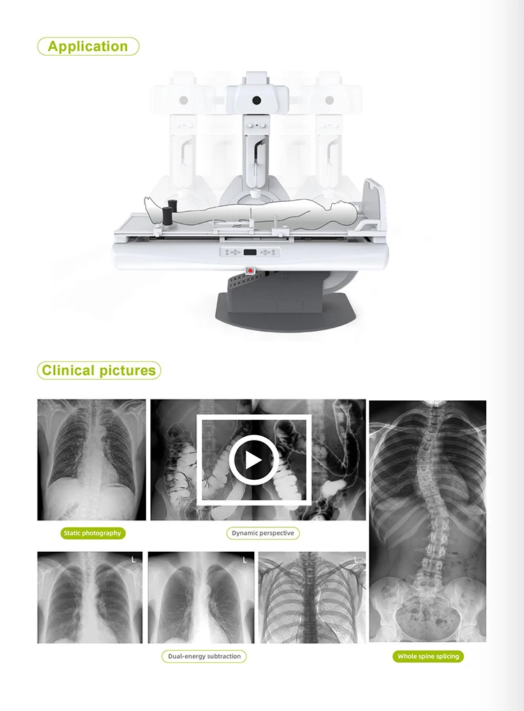 YSX-RF65D Ysenmed Medical Digital Xray Machine Dynamic X-ray Photography System X-ray Fluoroscopy System
