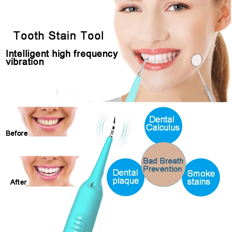 Электрическая звуковая зубная щетка для удаления зубного камня и зубного камня