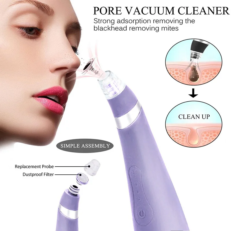 blackhead removers
