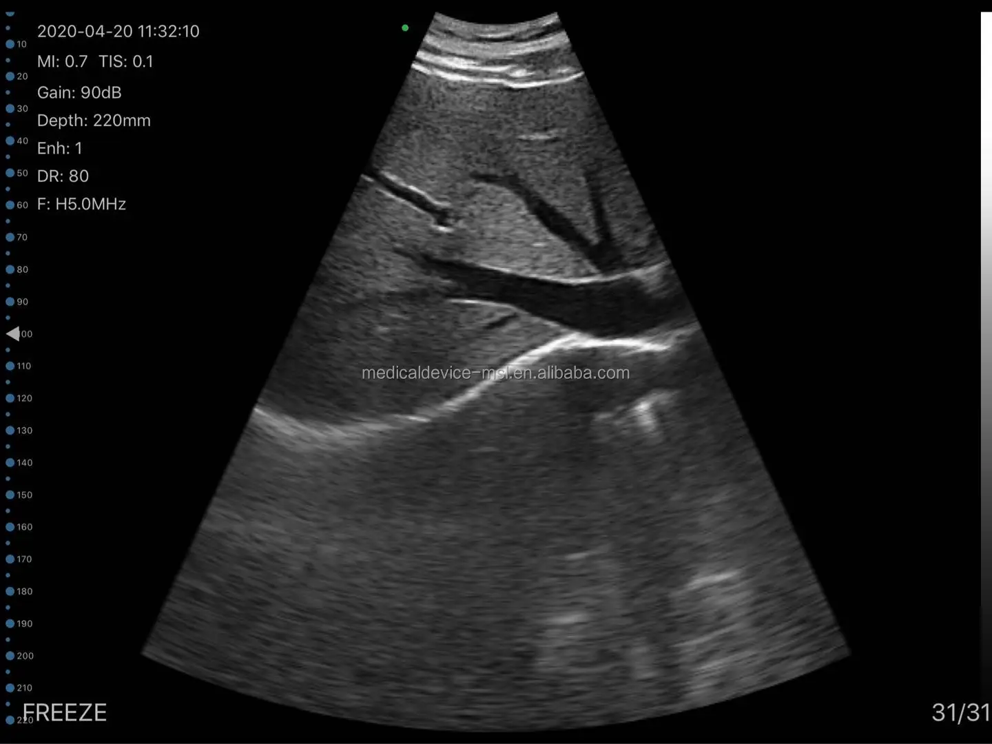 Stable color wireless ultrasound probe MSLPU2