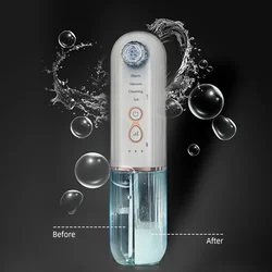 JOSUNN Electric Portable Beauty Device Facial Skin Care Pore Cleaner Comedo Suction Hot Cold Blackhead Remover With Water