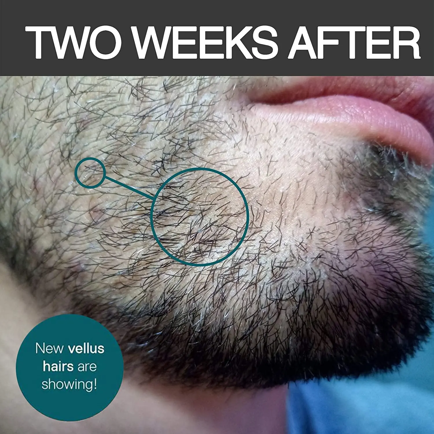 IN STOCK amazon hot selling premium man beard growth grooming kit with beard roller private label beard care kit.jpg