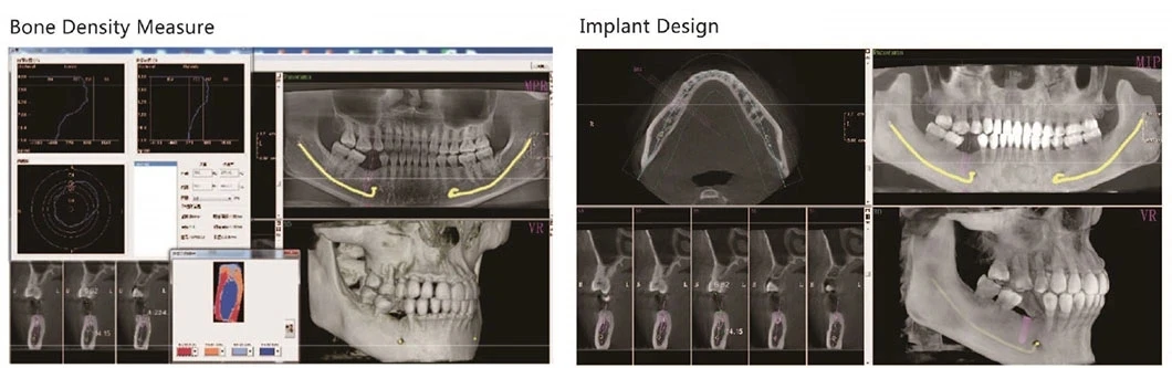 High Quality Digital Radiography 3D CBCT Panoramic Dental X-ray Machine, Teeth Xray Scanner manufacture