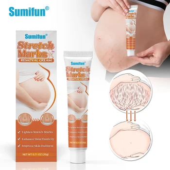 Stretch Mark Removal Cream Anti Wrinkle Anti Scars Shea Butter VC Natural Skin Repair Remove Stretch Mark Cream Pregnancy