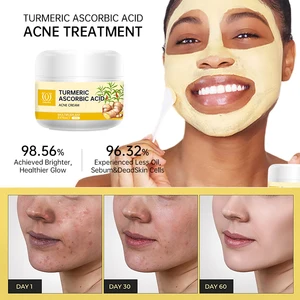 Turmeric Acne Serum 50ml Herbal Facial Treatment for Hemorrhoids Whitening & Brightening Glycerin Hyaluronic Acid Kojic Acid