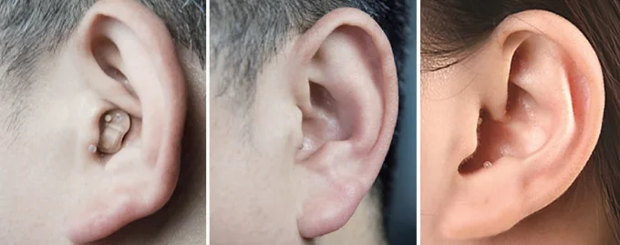 Wearing Display of Hearing Aids