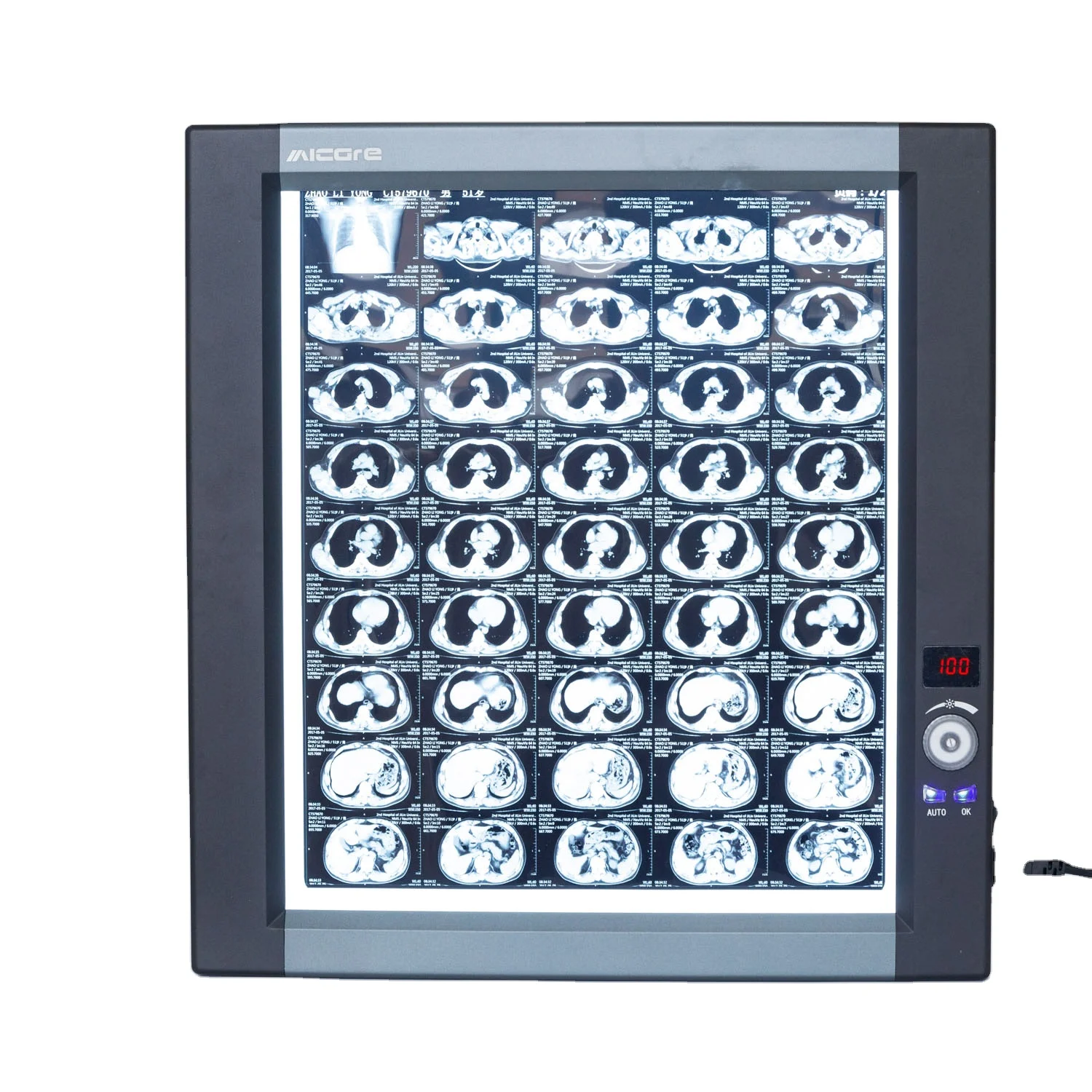 Led X Ray Viewer Negatoscope  Medical X-ray    X-ray Films  Negatoscope Price