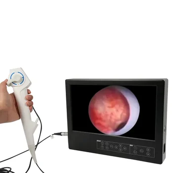 High-definition portable endoscope, high-quality and high-precision medical human body detection special endoscope