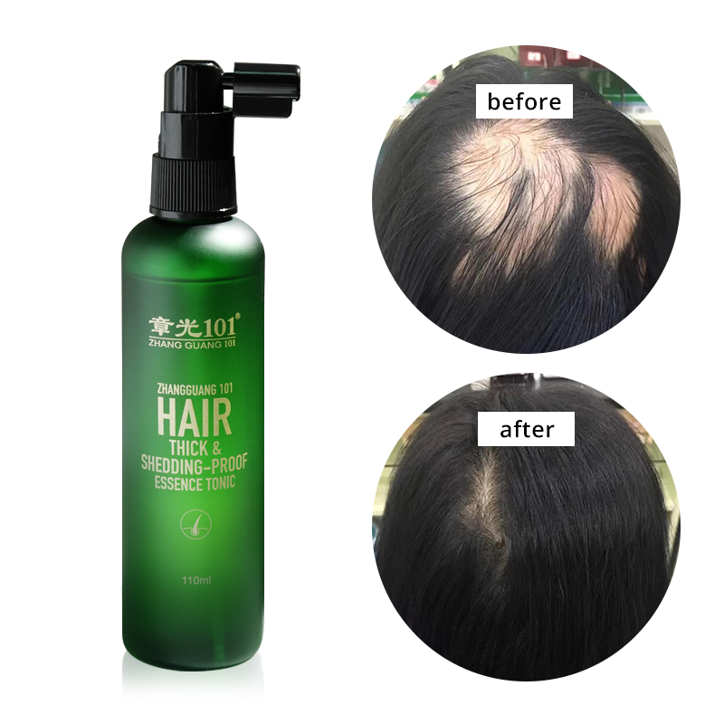 OEM Высокоэффективная Сыворотка для лечения выпадения волос Kopexil