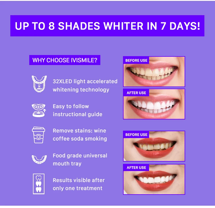 Private Label Rechargeable Wireless Teeth Tooth Whitening Light White