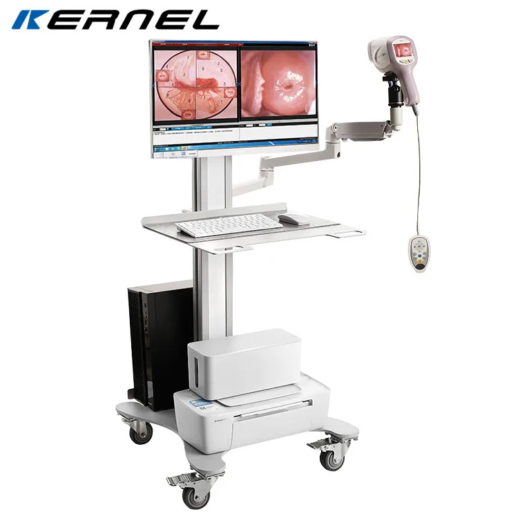 Kernel KN2200I HD CCD Camera Digital Video Kernel Optic Colposcope for Gynecology Colposcopy with Software
