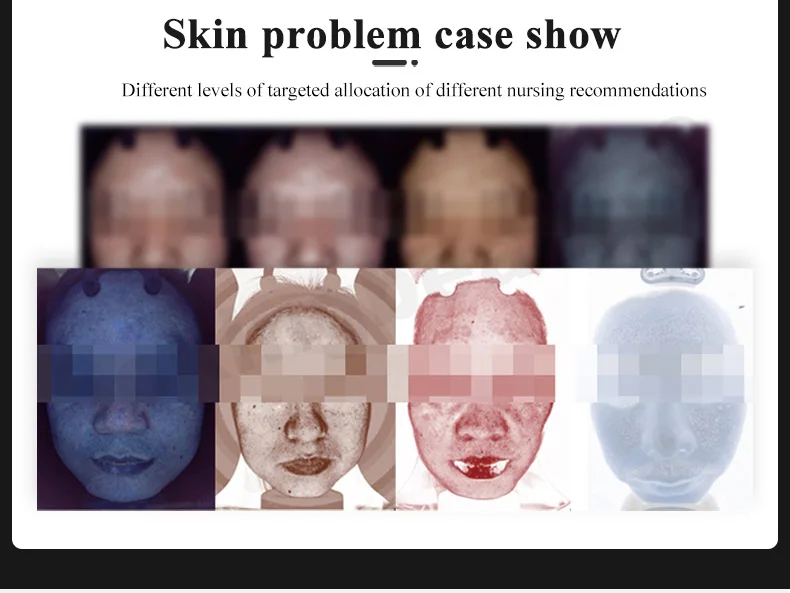 Portable Magic Face Mirror Skin Analyzer Face Skin Analysis Machine Beauty Equipment Facial Equipment Skin Scanner Analyzer
