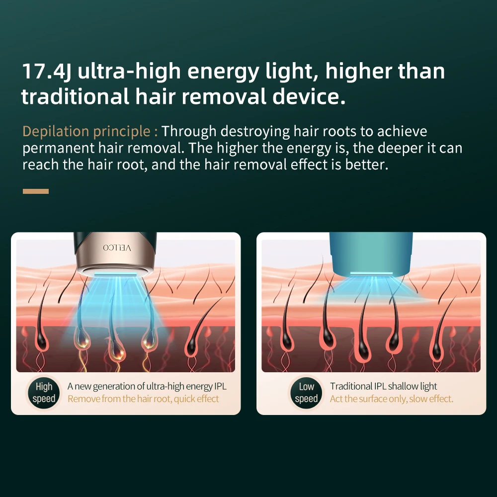 2023 Professional Epilator Home Use Hair Removal Device Diode Laser