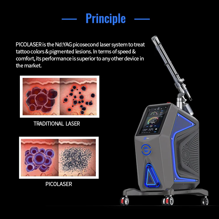 Korea Lab 7 Joints Arm Pico Laser Nd Yag Device for Tattoo Removal