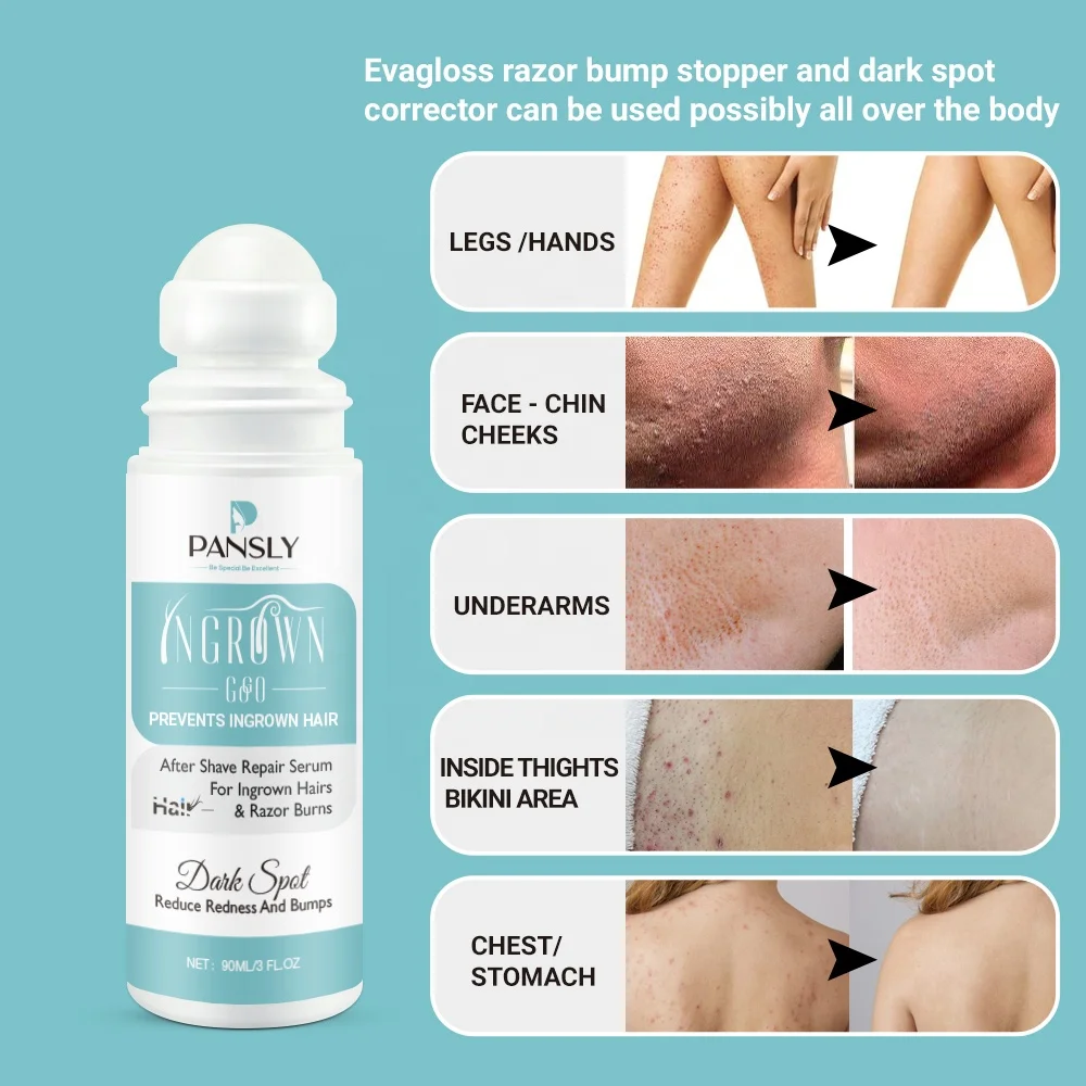 100% Natural Formula Remove Dark Spot After Shave Razor Bumps Treatment Solution Ingrown Hair Removal Roll on Ingrown Hair Serum