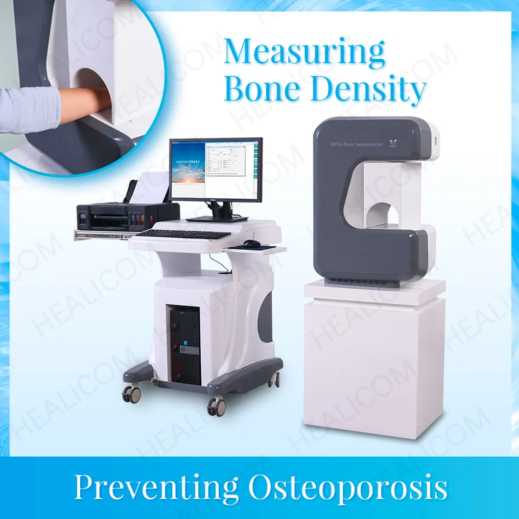 Bone Densitometry Equipment X Ray Bone Densitometer Preventing Osteoporosis Dual Energy DEXA Absorptiometry