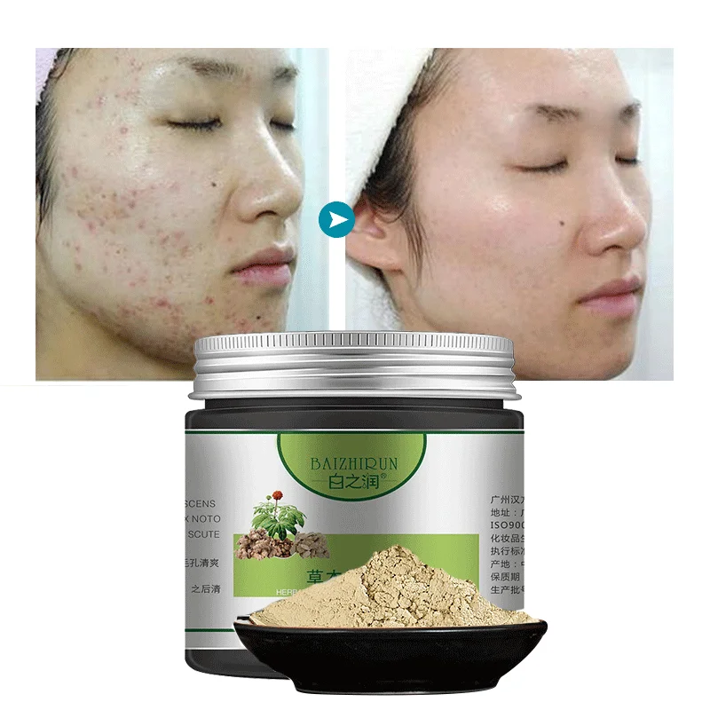 OEM/ODM private label customized Chinese herbaceous plant Acne treatment remove medicine powder/glay skin care facial  mask