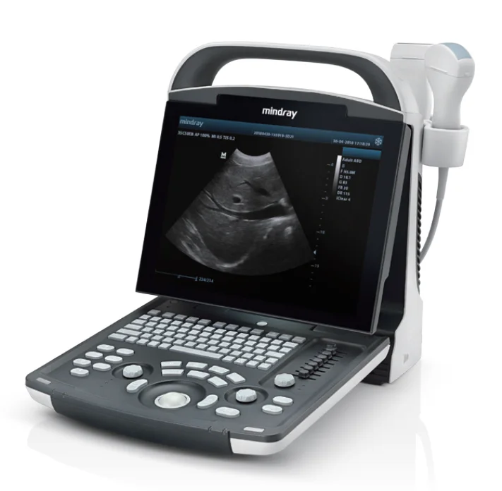 Mindray Z60 Ultrasound Mindray Dp 10 Ultrasound Mindray Dp 20 Ultrasound Machine