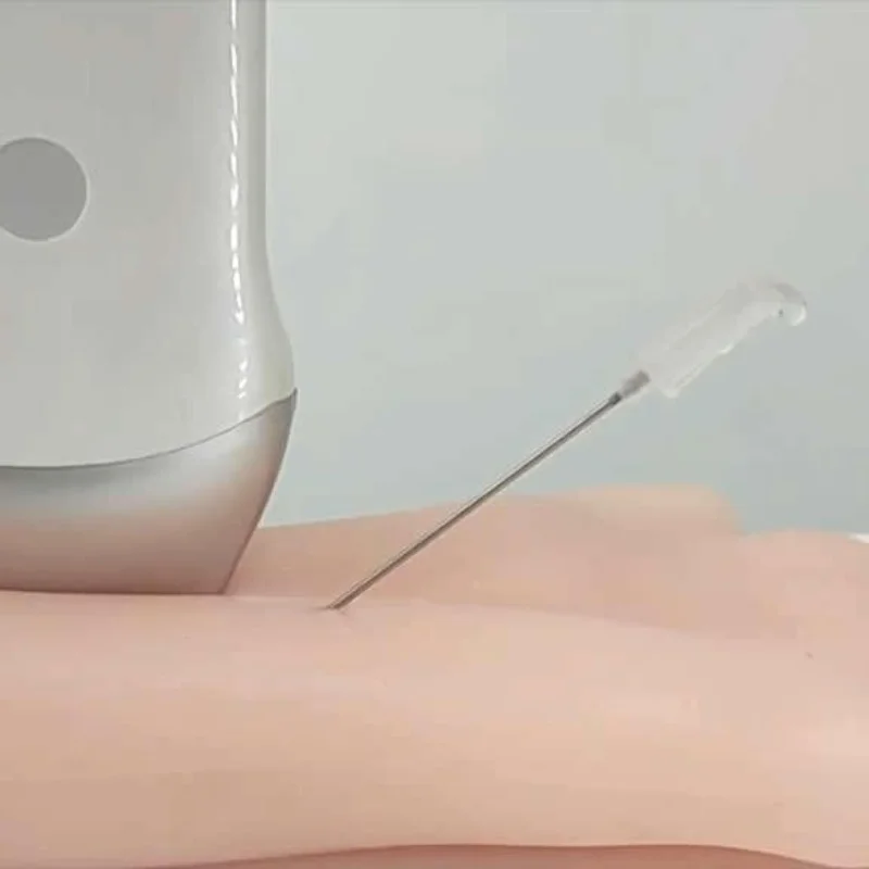 B-ultrasound Arteriovenous Fistula Training Model for Percutaneous Transluminal Angioplasty (PTA)