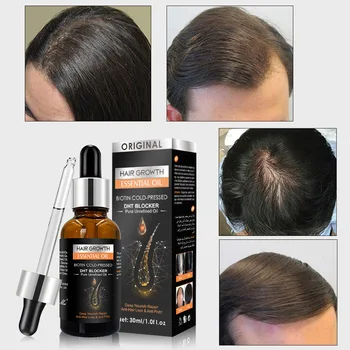 Dissar Organic Hair Loss Growth Oil Nourishing and Moisturizing Hair Care Essential Oil