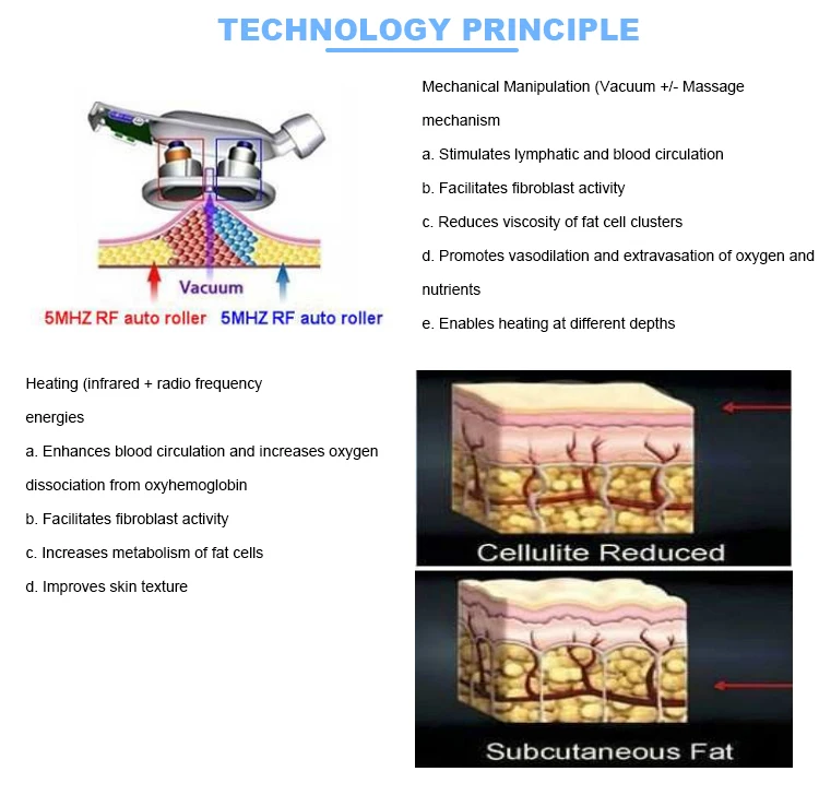 Description Picture 5 of itemLatest Upgrade Factory direct sales V909A beauty salon fat cavitation fat reduction vacuum roller massage body shaping machine