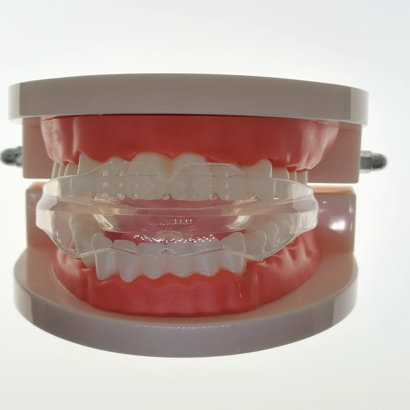 mouth guard 01.jpg