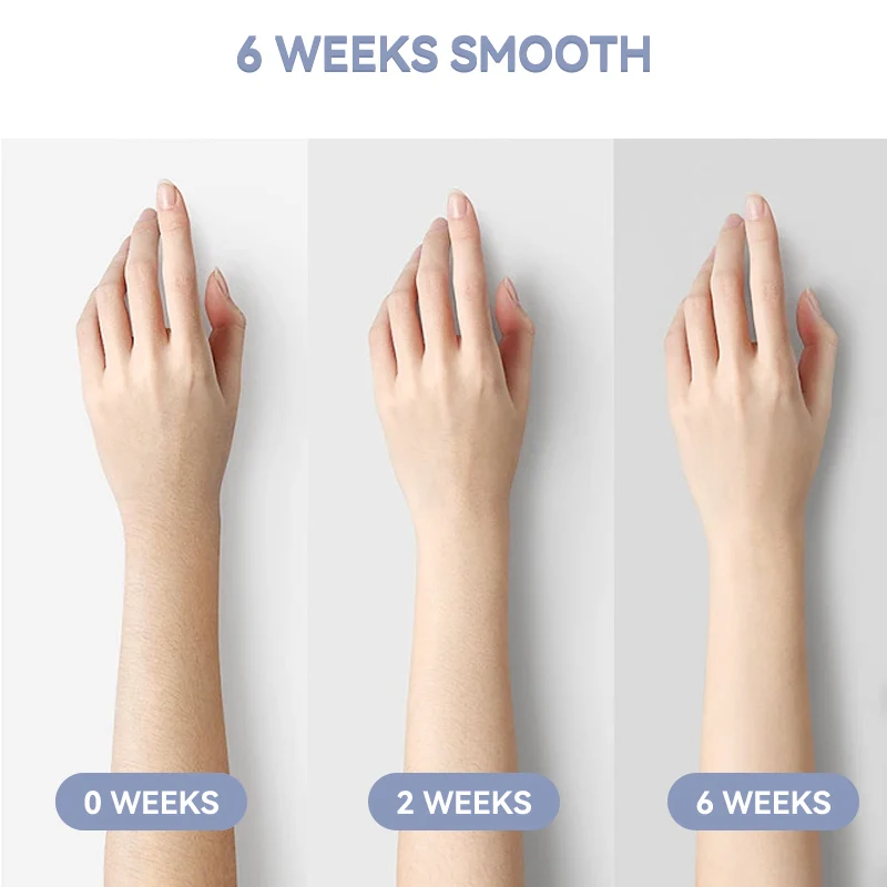 Устройство для безболезненного удаления волос с эффектом