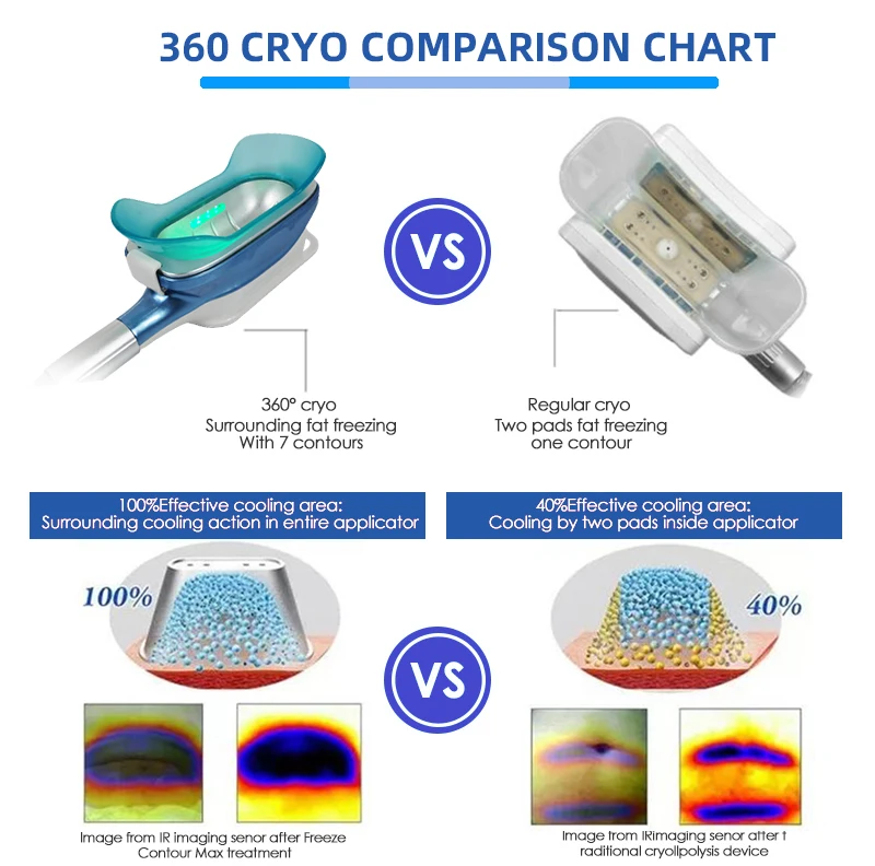 Fat Freezing Machine Cryolipolysis Slimming Machine 360 Cryolipolysis Slimming Machine Body Shape