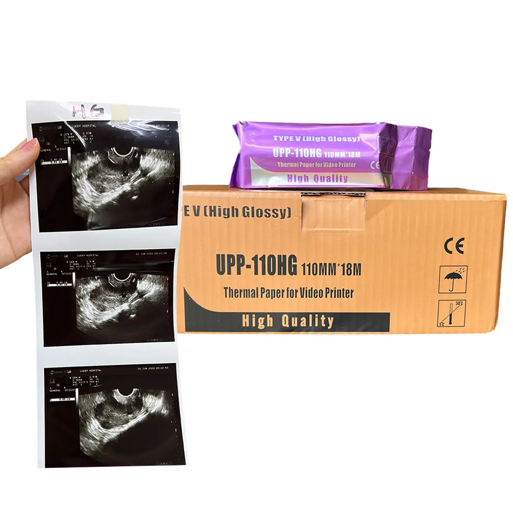 High Gloss Medical a Grade Upp-110hg Medical Ultrasound Original 110s Black White Print Efd Ecg Type v Thermal Paper Roll
