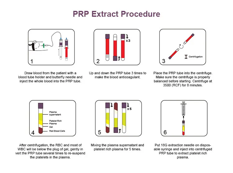 Medical Platelet Rich Plasma Prp Tube Prp With Acd Gel For Sale In Lab ...