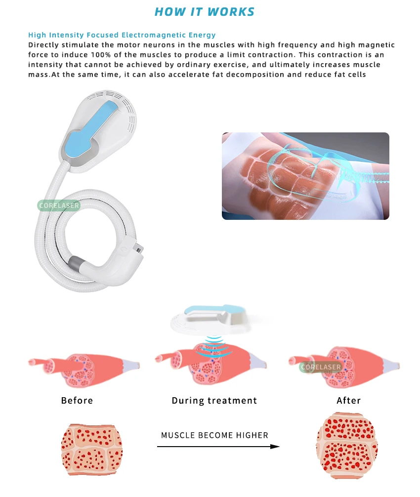 ems sculpting machine (2).jpg