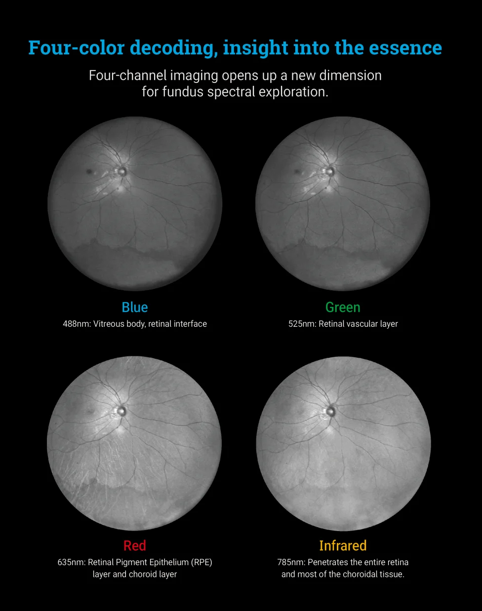 170&deg; Ultra Wide Field Fundus Imaging System Retinal Camera with Four Laser Sources and Automatic Eye Positioning