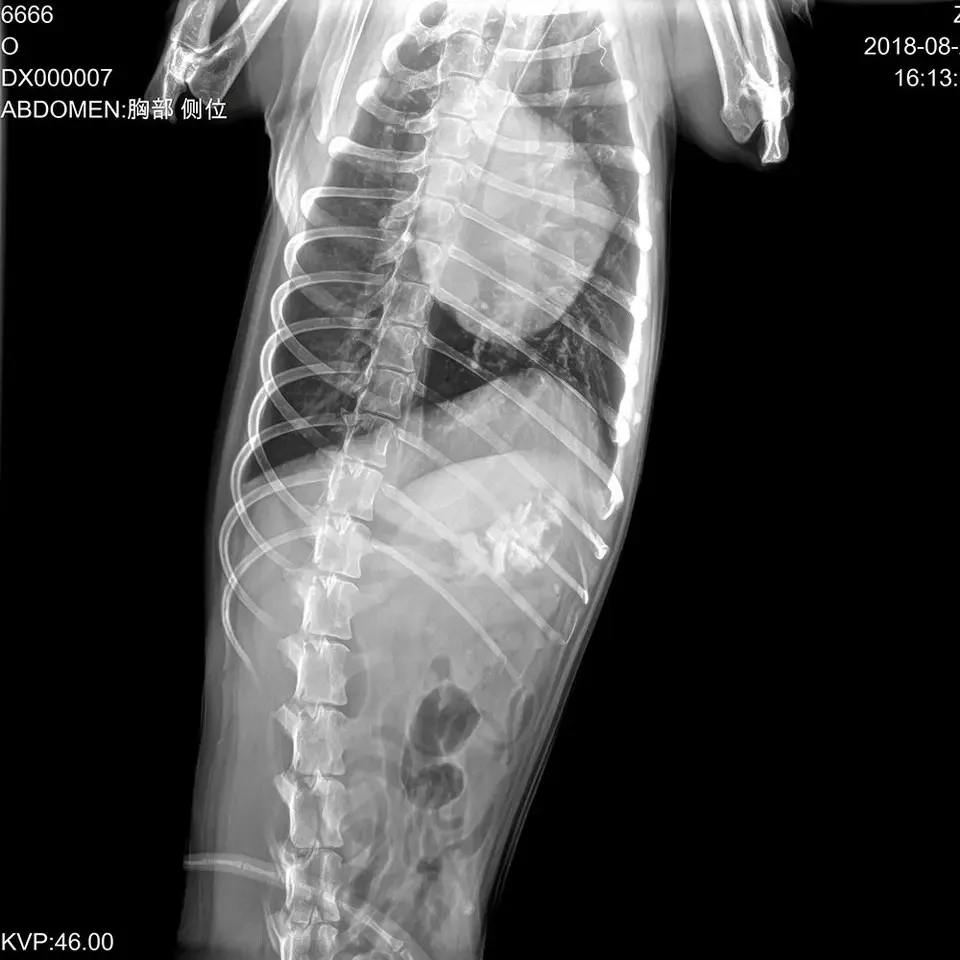 Wireless Digital Flat Panel Detector Wireless Digital Flat Panel Detector