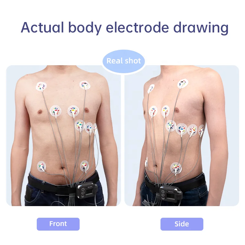 thumbnail image 2 of Livenpace TH12 12-Lead Dynamic ECG/EKG Holter Recorder - 24 Hour With AI Analysis 2 of 6