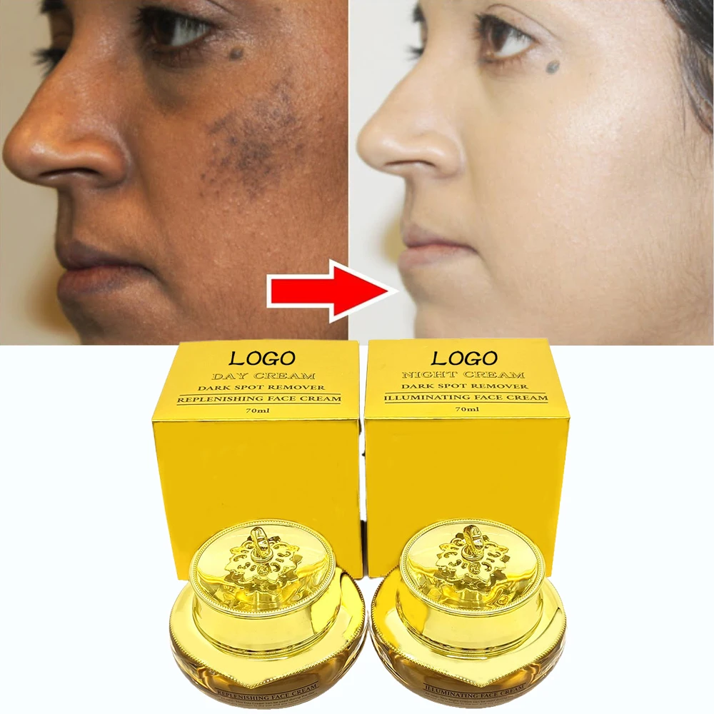 african glutathione whitening night cream NAC vs Glutathione: Differences, Similarities And Health Benefits main image 1