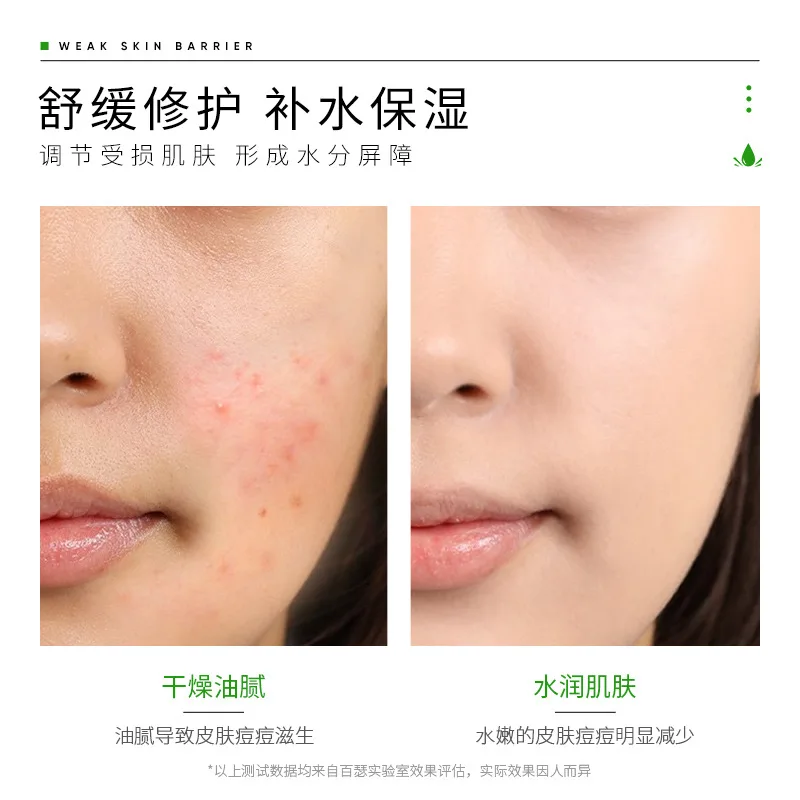 
 Рекомендуемый продукт бессер Curacao Aloe Vera Gel укрепляющая кожу маска увлажняющая улучшает шероховатость, освежающий, анти-АКС  