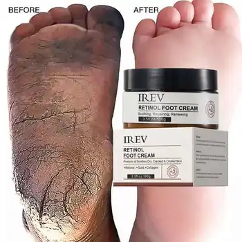 Skin Care for Cracked Heels Exfoliating Skin Rejuvenation Foot Moisturizer Cream