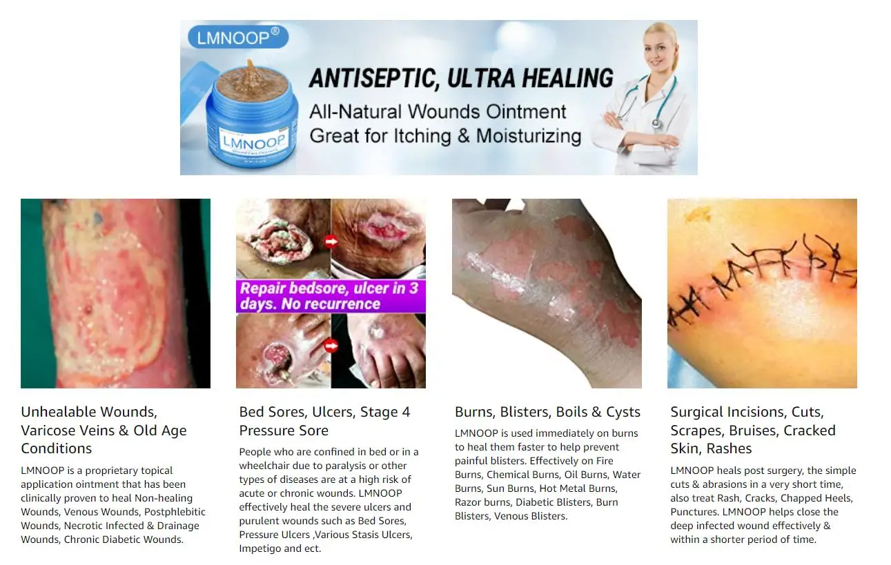 Ointment For Ulcer Wounds Caused By Vascular Diseases Such As Chronic ...