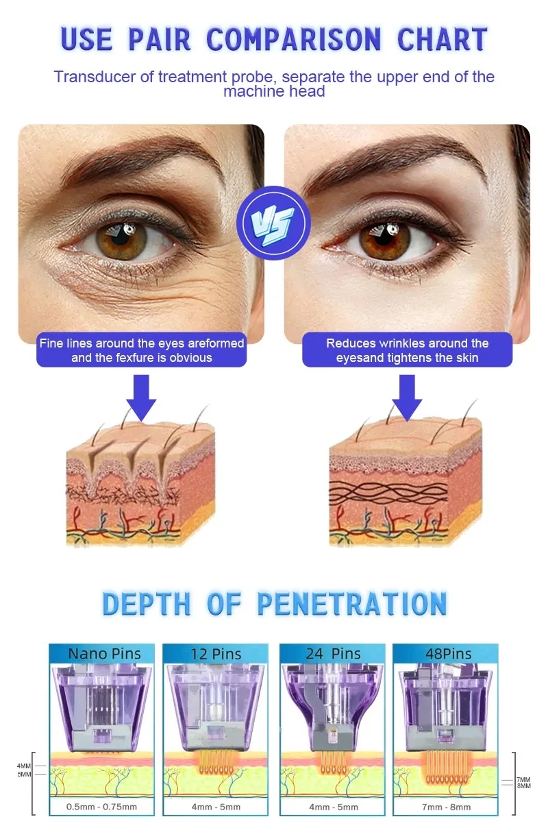 Crystallite Depth M8 Microneedle RF Acne Treatment Machine Depth 8 RF Machine Price in 2024